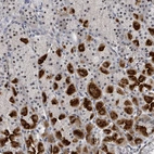 Anti-TRDMT1 Antibody