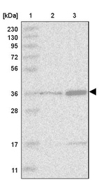 Anti-TRDMT1 Antibody
