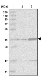 Lane 1: Marker [kDa] 230, 130, 95, 72, 56, 36, 28, 17, 11_br/_Lane 2: Human cell line RT-4_br/_Lane 3: Human cell line U-251 MG