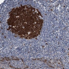 Anti-NCAPD2 Antibody
