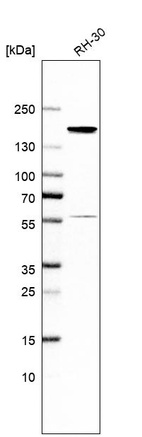 Western blot analysis in human cell line RH-30.
