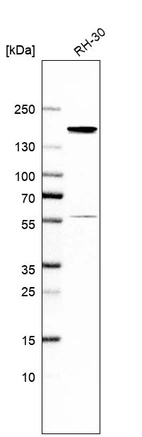 Western blot analysis in human cell line RH-30.