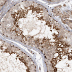 Anti-RAI14 Antibody