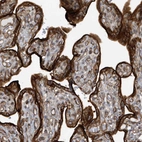 Immunohistochemical staining of human placenta shows strong cytoplasmic and membranous positivity in trophoblastic cells.