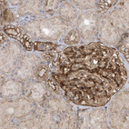Immunohistochemical staining of human kidney shows strong cytoplasmic and membranous positivity in cells in glomeruli and cells in tubules.