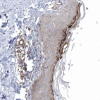 Immunohistochemical staining of human skin shows strong cytoplasmic positivity in squamous epithelial cells.