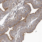 Immunohistochemical staining of human fallopian tube shows strong membranous positivity in glandular cells.