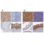 Immunohistochemical staining of human cerebral cortex, lymph node, testis and urinary bladder using Anti-SRGAP3 antibody HPA036959 (A) shows similar protein distribution across tissues to independent antibody HPA044074 (B).