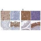 Immunohistochemical staining of human cerebral cortex, lymph node, testis and urinary bladder using Anti-SRGAP3 antibody HPA036959 (A) shows similar protein distribution across tissues to independent antibody HPA044074 (B).