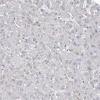 Immunohistochemical staining of human liver shows no positivity in hepatocytes as expected.