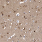 Immunohistochemical staining of human cerebral cortex shows high expression.