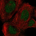 Immunofluorescent staining of human cell line A-431 shows localization to nucleus & cytosol.