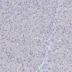 Immunohistochemical staining of human pancreas shows low expression as expected.