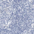 Immunohistochemical staining of human lymph node using Anti-SRGAP3 antibody HPA036959.