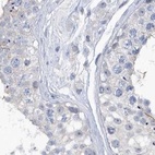 Immunohistochemical staining of human testis using Anti-SRGAP3 antibody HPA036959.