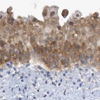 Immunohistochemical staining of human urinary bladder using Anti-SRGAP3 antibody HPA036959.