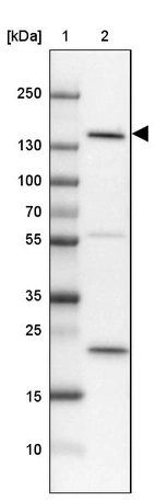 Lane 1: Marker [kDa] 250, 130, 100, 70, 55, 35, 25, 15, 10_br/_Lane 2: Human Cerebral Cortex tissue