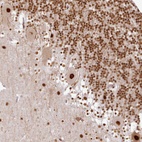 Anti-SYT15 Antibody