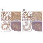 Anti-PGAM5 Antibody