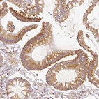 Immunohistochemical staining of human colon shows moderate granular cytoplasmic positivity in glandular cells.