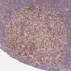 Anti-PGAM5 Antibody