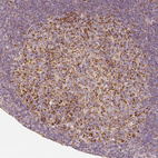 Immunohistochemical staining of human tonsil shows moderate granular cytoplasmic positivity in germinal center cells.