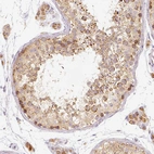 Immunohistochemical staining of human testis shows moderate granular cytoplasmic positivity in cells in seminiferous ducts.