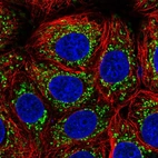 Immunofluorescent staining of human cell line MCF7 shows localization to mitochondria.