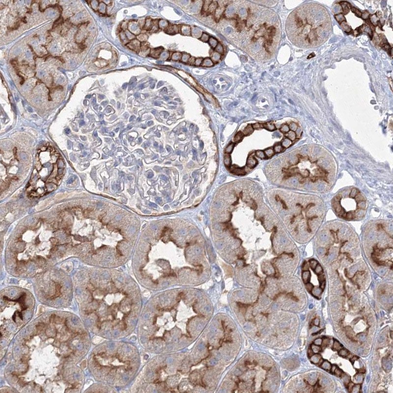 Anti-TMEM139 Antibody