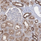 Anti-TMEM139 Antibody