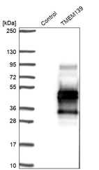 Western blot analysis in control (vector only transfected HEK293T lysate) and TMEM139 over-expression lysate (Co-expressed with a C-terminal myc-DDK tag (~3.1 kDa) in mammalian HEK293T cells, LY407062).
