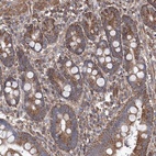 Anti-TMEM139 Antibody