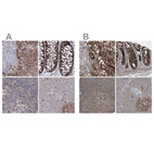 Immunohistochemical staining of human adrenal gland, colon, lymph node and pancreas using Anti-GRSF1 antibody HPA036984 (A) shows similar protein distribution across tissues to independent antibody HPA036985 (B).
