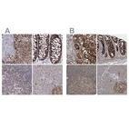 Immunohistochemical staining of human adrenal gland, colon, lymph node and pancreas using Anti-GRSF1 antibody HPA036984 (A) shows similar protein distribution across tissues to independent antibody HPA036985 (B).