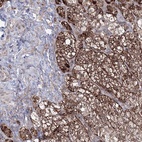 Immunohistochemical staining of human adrenal gland shows high expression.