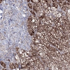 Immunohistochemical staining of human adrenal gland shows high expression.