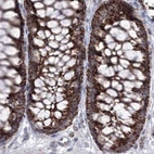 Immunohistochemical staining of human colon using Anti-GRSF1 antibody HPA036984.