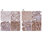 Anti-QARS Antibody