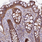 Immunohistochemical staining of human rectum shows strong cytoplasmic positivity in glandular cells.