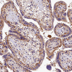Immunohistochemical staining of human placenta shows moderate cytoplasmic positivity in trophoblastic cells.