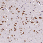 Immunohistochemical staining of human cerebral cortex shows strong cytoplasmic positivity in neurons.