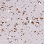 Immunohistochemical staining of human cerebral cortex shows strong cytoplasmic positivity in neurons.