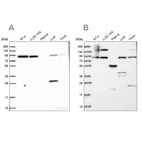 Western blot analysis using Anti-QARS antibody HPA036986 (A) shows similar pattern to independent antibody HPA036987 (B).