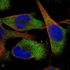 Immunofluorescent staining of human cell line U-251 MG shows localization to cytosol.