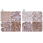 Anti-QARS Antibody