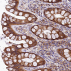 Immunohistochemical staining of human rectum shows strong cytoplasmic positivity in glandular cells.