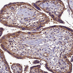 Immunohistochemical staining of human placenta shows strong cytoplasmic positivity in trophoblastic cells.