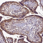 Immunohistochemical staining of human placenta shows strong cytoplasmic positivity in trophoblastic cells.