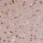 Immunohistochemical staining of human cerebral cortex shows strong cytoplasmic positivity in neurons.