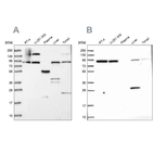 Western blot analysis using Anti-QARS antibody HPA036987 (A) shows similar pattern to independent antibody HPA036986 (B).